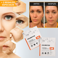 KIT GOLDBOTOX™ - COLÁGENO + ACIDO HIALURÓNICO + ACTIVO DE BOTOX