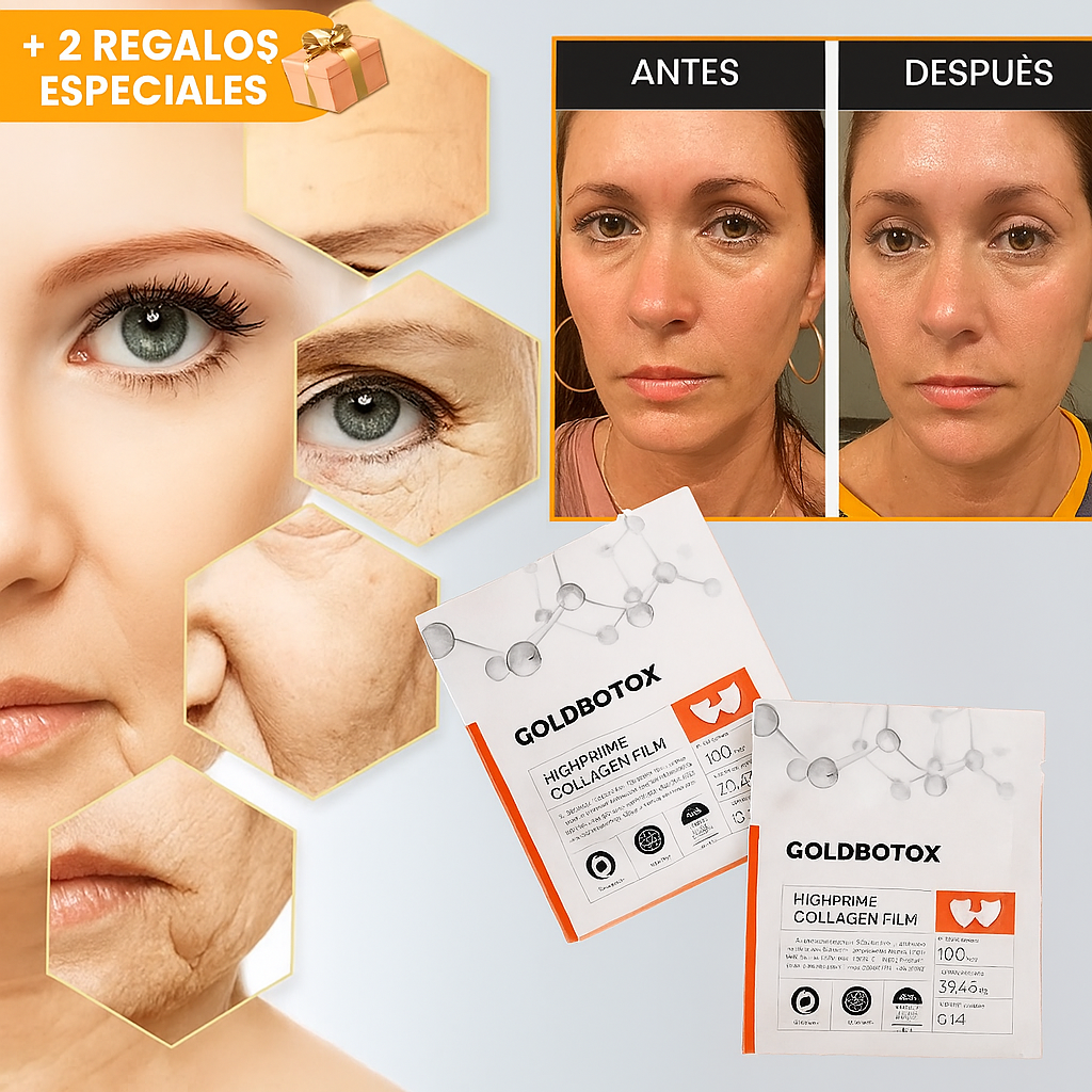 KIT GOLDBOTOX™ - COLÁGENO + ACIDO HIALURÓNICO + ACTIVO DE BOTOX